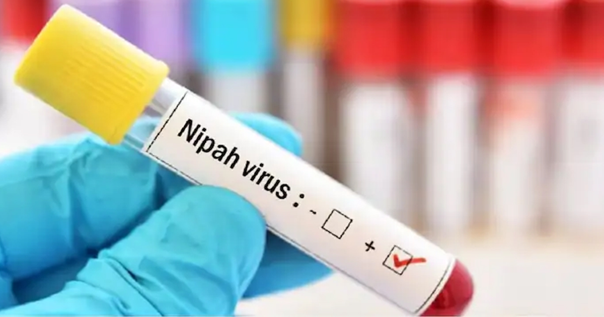 राज्य में निपाह संक्रमितों के निशान मिले, संक्रमण से निपटने के लिए राज्य ने SOP तैयार किया